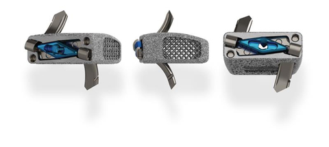 Blackhawk Ti Standalone Cervical Spacer System (Photo: Business Wire)
