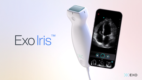 A New Age of Ultrasound: Exo Iris (Graphic: Business Wire)
