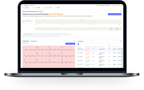 Screen shot of sample data from Anumana's ECG-AI LEF, a breakthrough artificial intelligence (AI)-powered medical device to detect low ejection fraction (LEF) in patients at risk of heart failure. Source: Anumana
