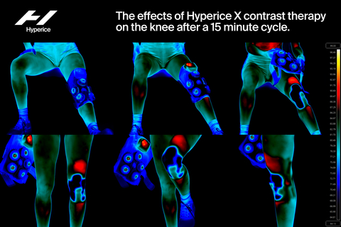 thumbnail The effects of a 15-minute Hyperice X contrast therapy session (Photo: Business Wire)