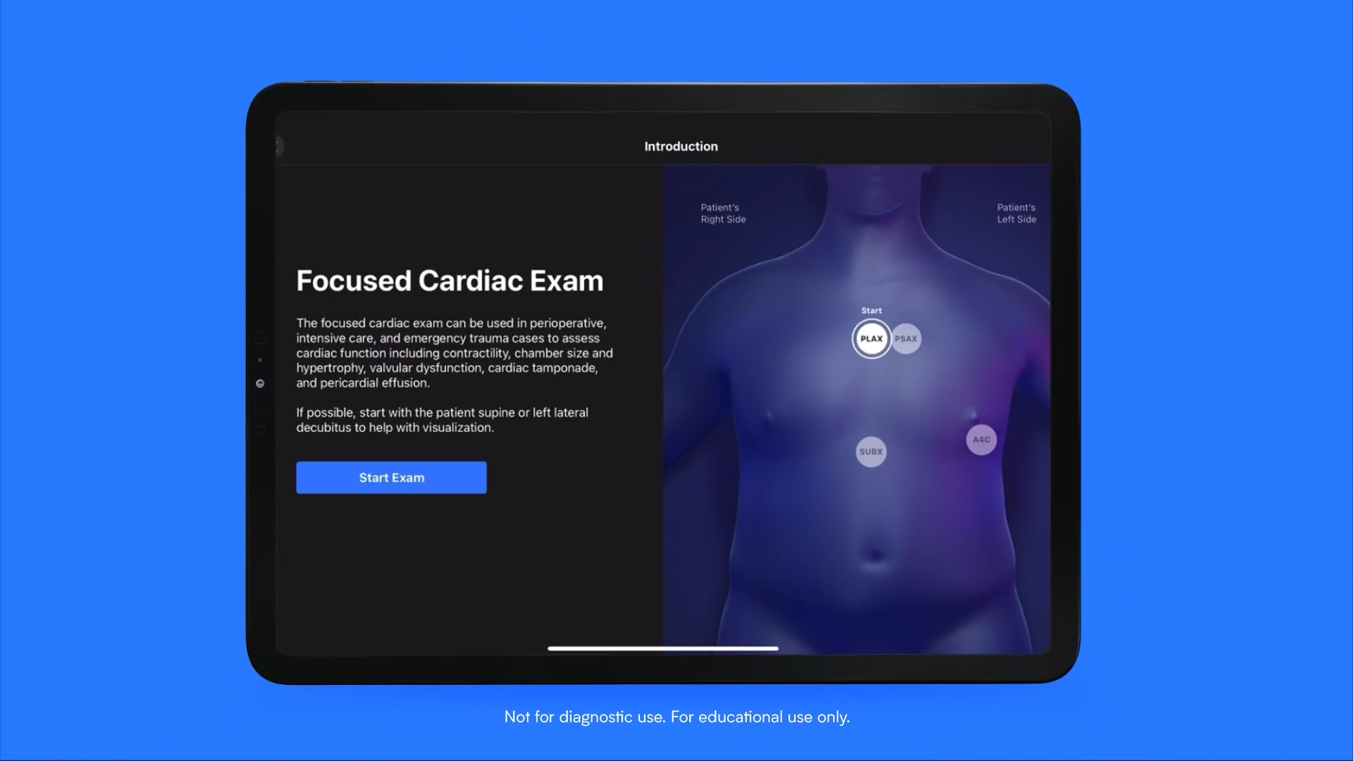 ScanLab™, an artificial intelligence (AI)-powered educational application for ultrasound scanning practice, coming soon from Butterfly Network. (Photo: Business Wire)