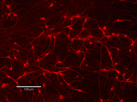 CRISPR-Ready ioGlutamatergic Neurons (Graphic: Business Wire)