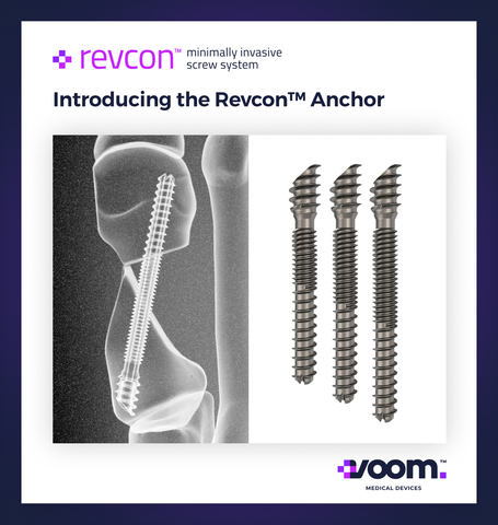 Voom™ Medical Devices launches the distinctive patented Revcon™ Anchor v2.0 screw, the only neutral non-compressive dual-zone pitched single screw solution for minimally invasive bunion surgery, exclusively used with the Bunionplasty® procedure. (Graphic: Business Wire)