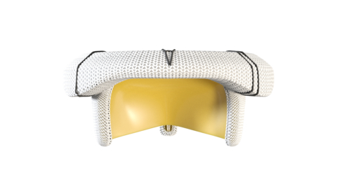 thumbnail The MITRIS RESILIA valve is made with innovative tissue technology RESILIA allowing the valve to potentially last longer than conventional bioprosthetic valves.*
