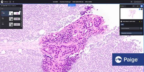 Paige Lymph Node is an AI application that assists pathologists in diagnosing cancer by highlighting each area of concern for further review. (Graphic: Business Wire)