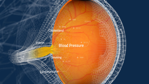 Toku's AI-powered CLAiR technology uses retina scans during regular eye exams to detect cardiovascular risk non-invasively. (Graphic: Business Wire)
