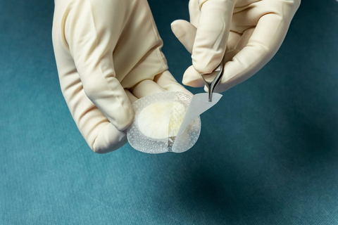 Kerecis' fish-skin grafts are available in various shapes and sizes, such as Kerecis Shield, as shown. (Photo: Business Wire)