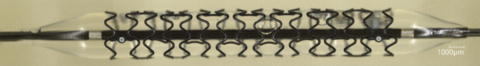 thumbnail Stent after expansion (Photo: Business Wire)