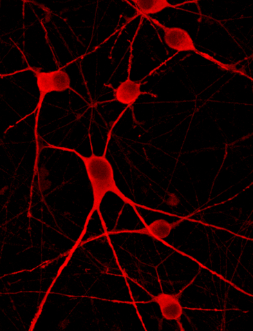 ioMotor Neurons (Photo: Business Wire)