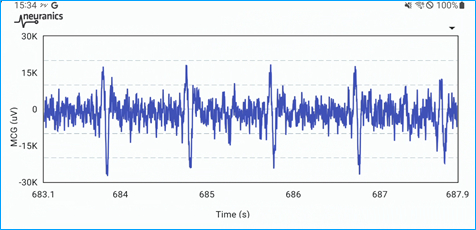 (Graphic: Neuranics)