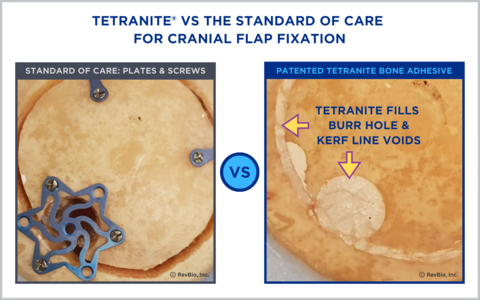 On the left is an image of standard metal fixation hardware consisting of bur hole covers and plates and screw systems that are used to re-affix cranial flaps following craniotomy procedures. On the right is TETRANITE® which fills the missing bone, seals the site from infection, and over time is resorbed and replaced with bone as demonstrated in RevBio’s pre-clinical testing. (Graphic: Business Wire)