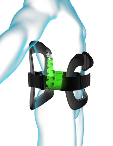 Image of the Orthofix SpinalStim Bone Growth Therapy device. (Graphic: Business Wire)