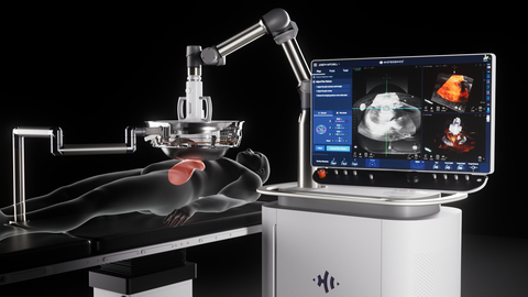 original HistoSonics Edison Histotripsy System (Photo: Business Wire)