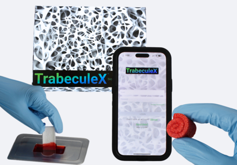 On January 11th, trailblazing medical technology company Xenco Medical unveiled its convergent technology bridging Digital Health and Biomaterials by showcasing its TrabeculeX Continuum™ at the 2024 Consumer Electronics Show in Las Vegas, Nevada. Comprising the TrabeculeX Bioactive Matrix™ and the TrabeculeX Recovery App™, the TrabeculeX Continuum is the first technology-enabled bridge between orthobiologics and digital health, unifying a patient’s biomaterial implantation and postoperative journey. (Graphic: Business Wire)