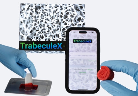 Xenco Medical presenta TrabeculeX Continuum, una convergenza innovativa di Digital Health e Biomaterials, al CES 2024 di Las Vegas, la fiera tecnologica più grande al mondo