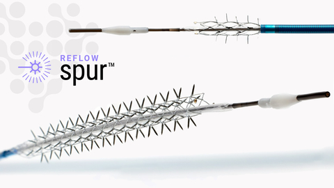 original The Bare Temporary Spur Stent System is a unique clinical solution known as Retrievable Stent Therapy, or RST. It is intended to provide stent-like results while leaving no metal behind. (Graphic: Business Wire)