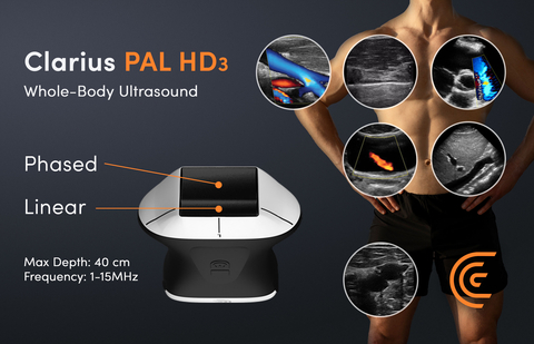 New Clarius PAL HD3 wireless handheld whole-body ultrasound scanner uniquely combines phased and linear arrays on a single head. It offers superior image quality of superficial and deep anatomy at the bedside. CE-Certified, it's now available in Europe, the United Kingdom and the United States.
