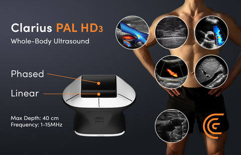 original New Clarius PAL HD3 wireless handheld whole-body ultrasound scanner uniquely combines phased and linear arrays on a single head. It offers superior image quality of superficial and deep anatomy at the bedside. CE-Certified, it's now available in Europe, the United Kingdom and the United States.