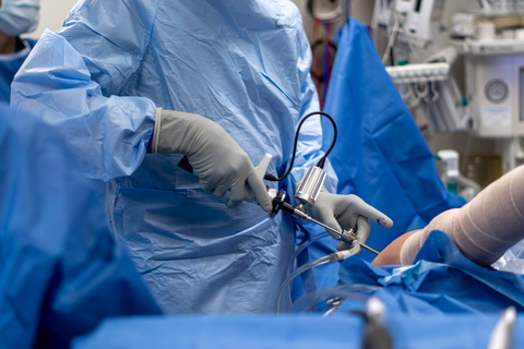 The ArthroFree wireless camera is designed to allow surgeons to operate with optimal dexterity and surgical ergonomics with a focus on the patient’s safety. (Photo: Business Wire)