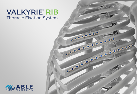 Able Medical received 510(k) clearance for its single-use, PEEK-based Valkyrie RIB System. (Graphic: Business Wire)