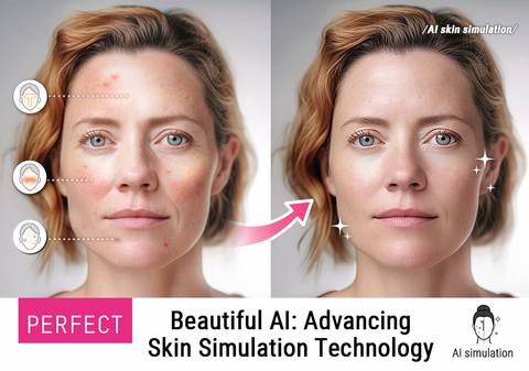 Perfect Corp. Expands AI Skin Simulation Technology, Helping Consumers Visualize Skin Improvements in Seconds (Photo: Business Wire)
