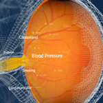 Toku Obtains CE and UKCA Marks for AI Cardiovascular Risk Assessments Through the Eye