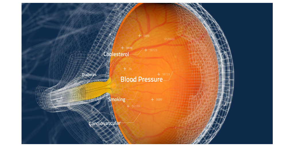  Toku ottiene la marcatura CE e UKCA per valutare il rischio di sviluppare malattie cardiache, utilizzando una scansione della retina