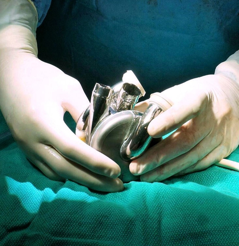 BiVACOR® Total Artificial Heart (TAH) in Surgeon's Hands (Photo: Business Wire)