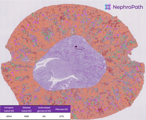 Figure 1. Illustration of the NephroPath platform’s capabilities in performing automated quantification and multi-class prediction on an entire rat kidney cortex. Notable classes: normal tubuli (orange), atrophic/dilated tubuli (green/red), glomeruli (pink), abnormal/sclerotic glomeruli (dark blue), arteries (light blue), interstitium (not colored).