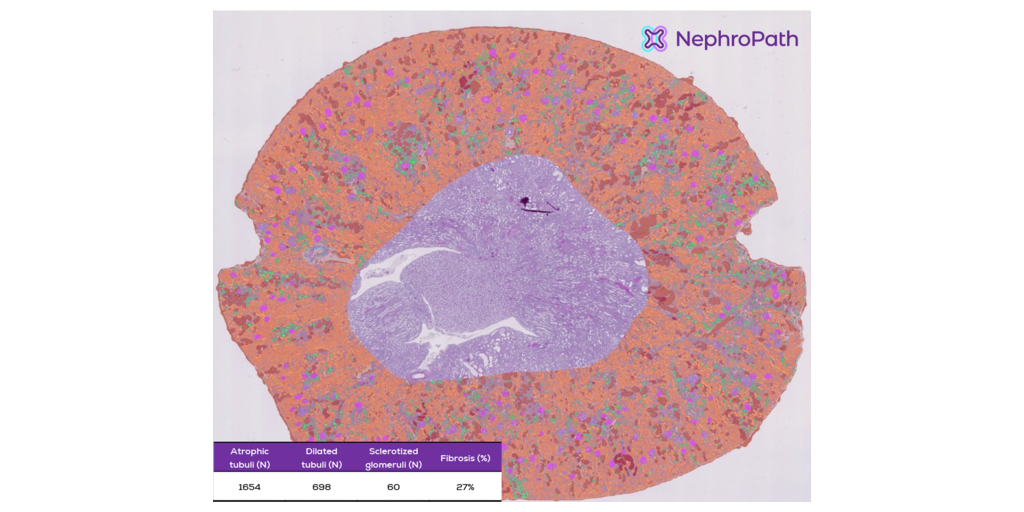  Aiosyn lancia i Servizi di analisi delle immagini renali attraverso la sua piattaforma NephroPath per accelerare gli studi di sviluppo dei farmaci