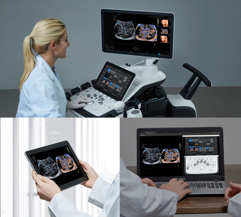 SonoSync offers real time collaboration with medical experts. (Photo: Business Wire)