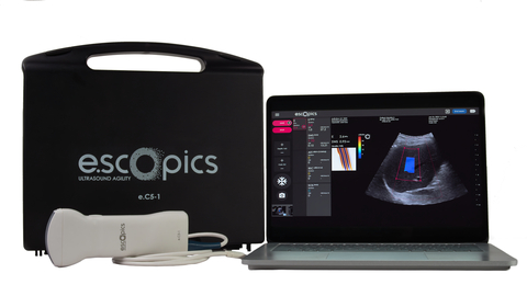 Liver-Assessment Tool Hepatoscope® Cleared for Use in U.S. and Europe Just as First Medication for MASH* Gains FDA Approval; E-Scopics’ Ultraportable, Software-Based Hepatoscope Is Currently Available To Identify Patients Who Can Benefit From Madrigal Pharmaceuticals’ Rezdiffra™ (Photo: Business Wire)