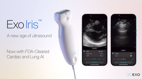 Exo Iris: Now with FDA-Cleared Cardiac and Lung AI (Photo: Business Wire)