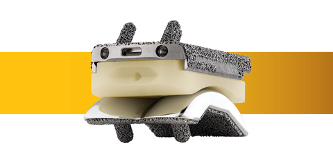 original Stryker's Infinity with Adaptis and Everlast Total Ankle System, featuring Prophecy Surgical Planning, is designed to deliver efficient and accurate implementation. (Photo: Business Wire)