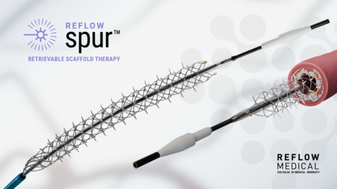 Spur Retrievable Scaffold Therapy (RST) features a retrievable stent with radially self-expanding spikes designed to treat the diseased vessel wall without leaving anything behind. (Graphic: Business Wire)