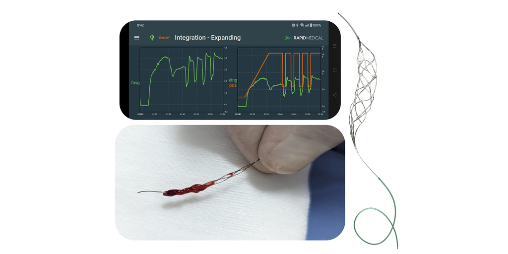 ラピッド・メディカル™が世界初のロボット血栓除去装置で虚血性脳卒中手技を成功裏に完了