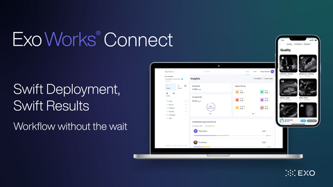 Exo Works® Connect (Graphic: Business Wire)