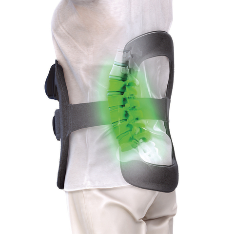 Orthofix SpinalStim bone growth therapy device. (Photo: Business Wire)