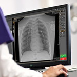  Carestream lancia Image Suite MR 10 Software per migliorare l’esperienza di produzione e documentazione di immagini per sistemi di imaging CR e DR