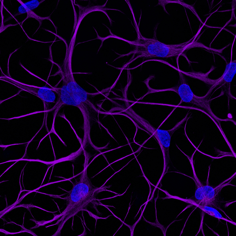 bit.bio Launches ioAstrocytes, Advancing How Scientists Can Model the Human Brain | BioSpace