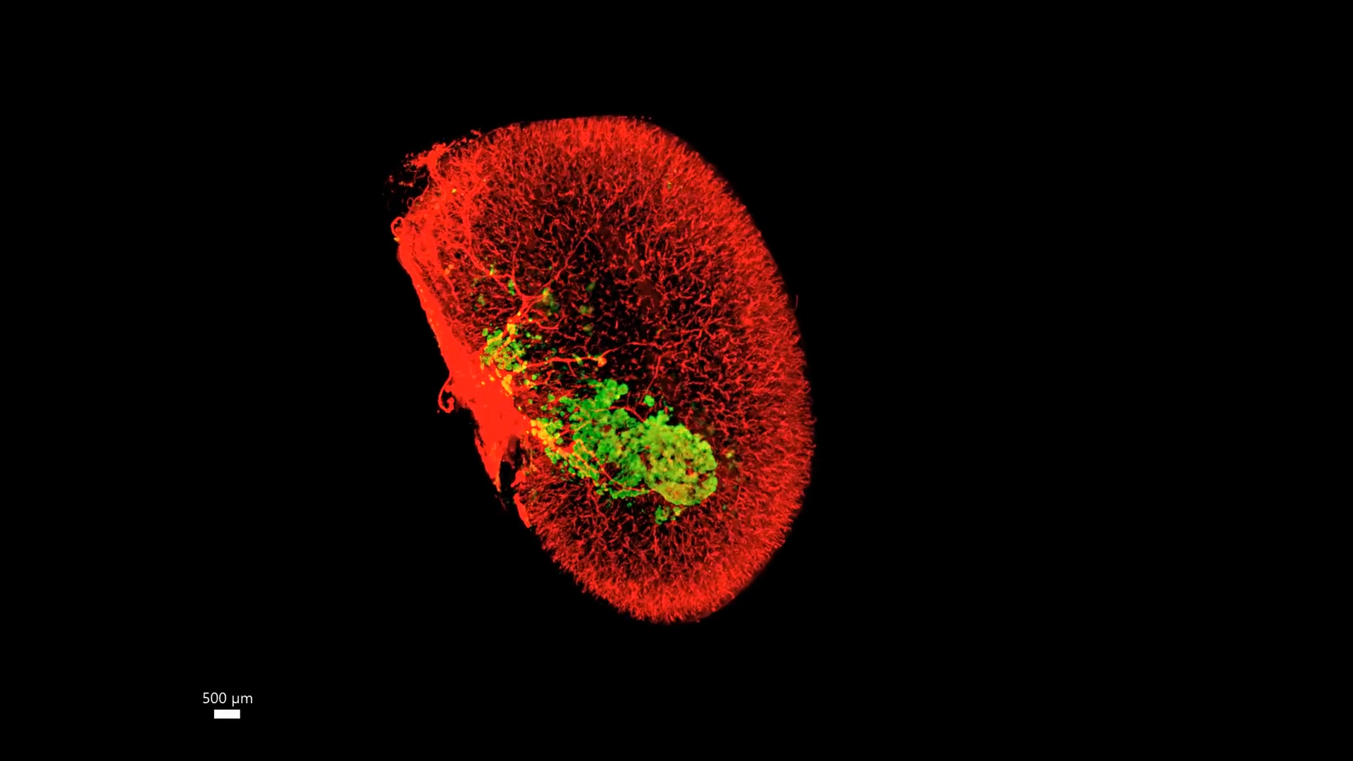 3-D image of a mouse kidney that has received human islet grafts. Beta cells are visible in green; red reveals the entire mouse kidney. Video credit: City of Hope/Mount Sinai Health System