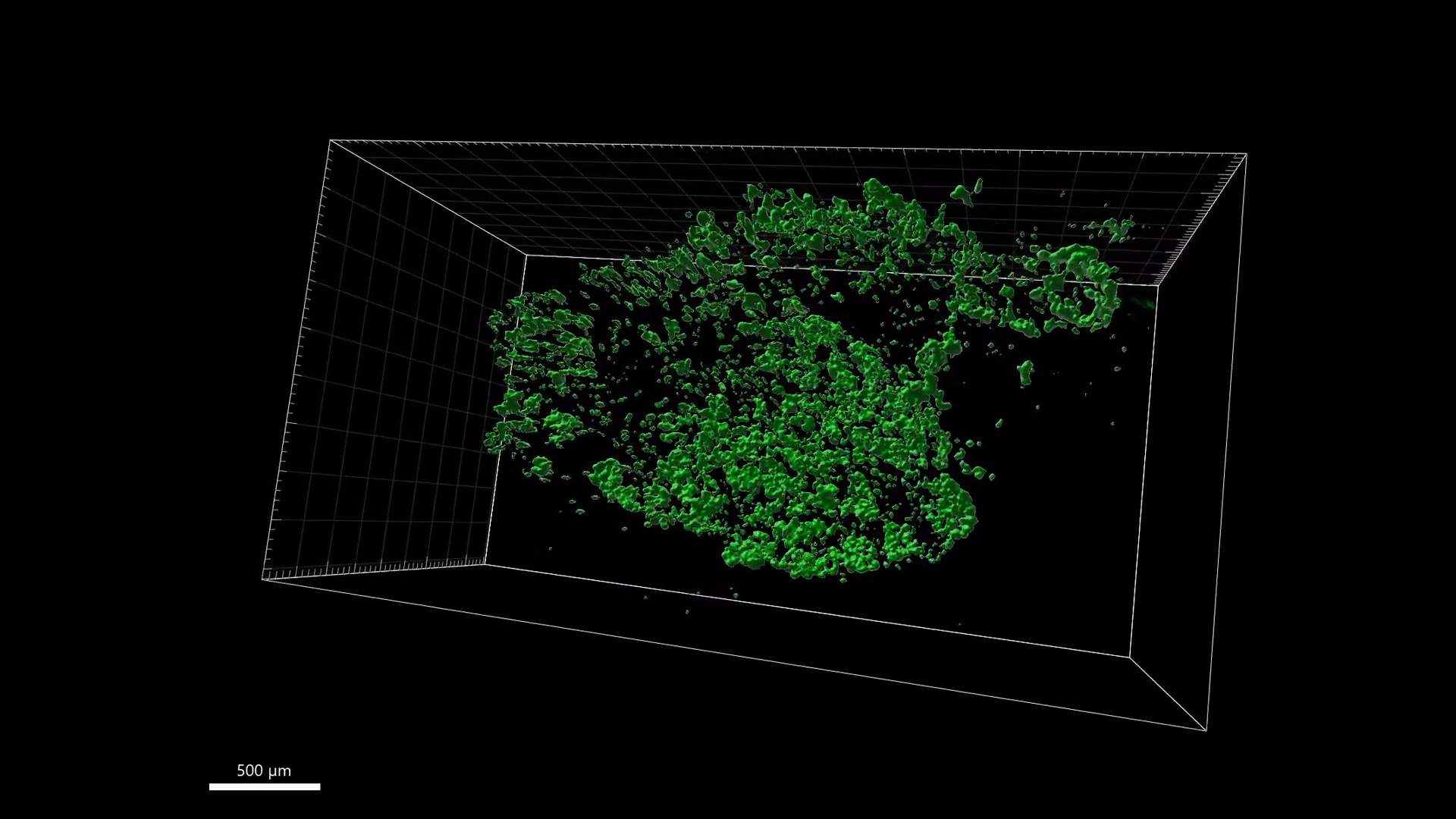 3-D image of human beta cell mass treated for three months with harmine plus exendin-4. Video credit: City of Hope/Mount Sinai Health System