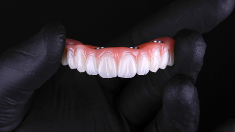 Flexcera Smile Ultra+ dental resin is now validated for implant-supported denture provisionals, also known as “All-on-X” prosthetics. All-on-X image courtesy of Absolute Dental Services in Durham, NC. (Photo: Business Wire)