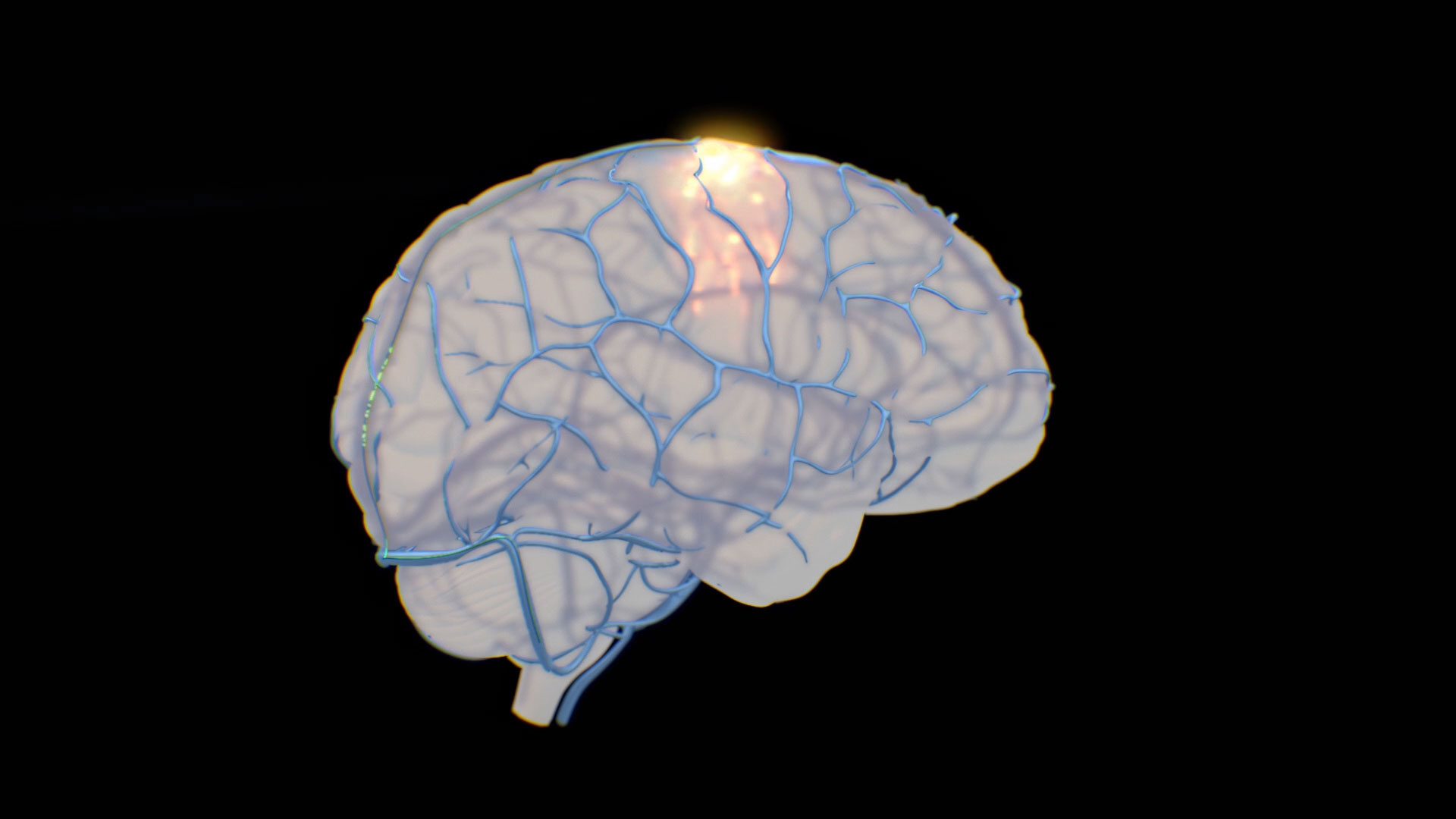 Synchron BCI animation. Video credit: Synchron