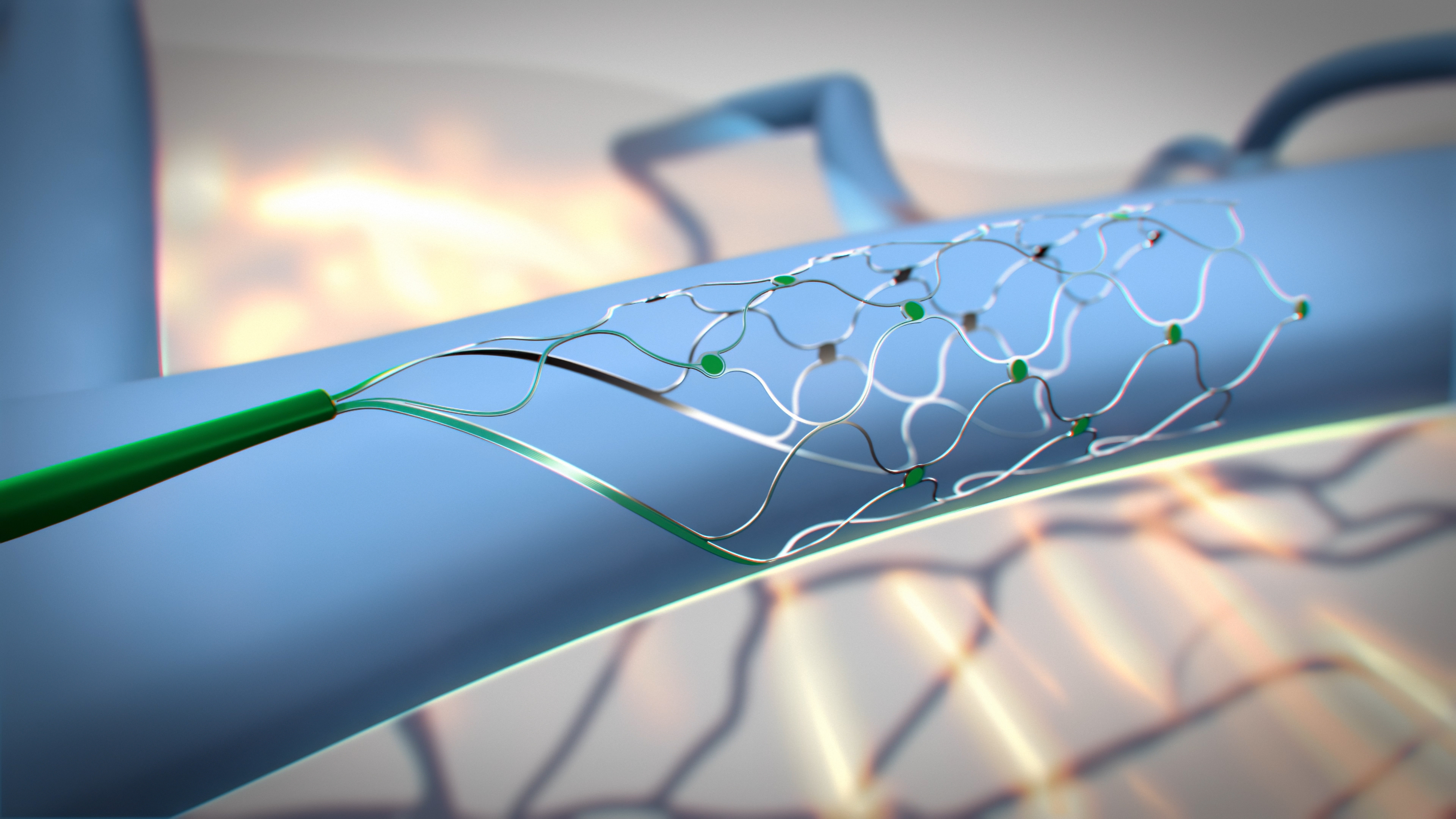 Stentrode™ is implanted within the motor cortex of the brain via the jugular vein in an endovascular procedure. (Credit: Synchron)