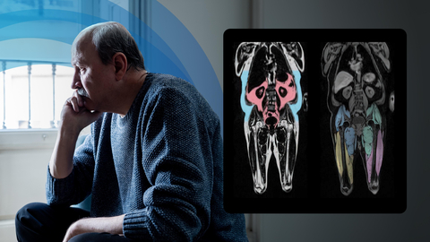 original Body composition measurements - an important tool for examining adverse treatment effects associated with the use of antidepressants (Photo: Business Wire)