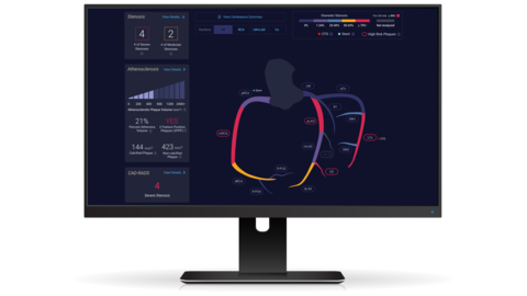 Cleerly Presents Late-Breaking Research on AI-Enabled Quantitative CT Coronary Assessment for Predicting Major Adverse Cardiovascular Events at TCT 2024 (Photo: Business Wire)