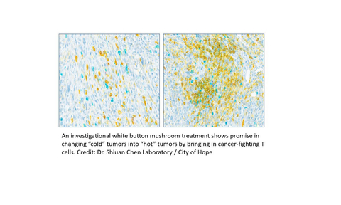 An investigational white button mushroom treatment shows promise in changing “cold” tumors into “hot” tumors by bringing in cancer-fighting T cells. Credit: Dr. Shiuan Chen Laboratory / City of Hope