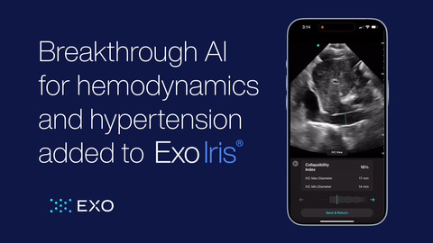 Breakthrough AI for hemodynamics and hypertension added to Exo Iris. (Graphic: Business Wire)