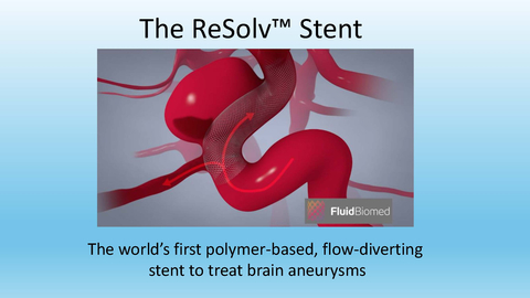 The ReSolv™ stent, being developed by Fluid Biomed, is the world’s first polymer-based stent for brain aneurysms, with the potential to save patients from a lifetime regimen of blood thinners following treatment. (Graphic: Business Wire)